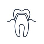 Stomatologia estetyczna - korona dentystyczna