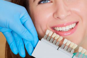 Wybielanie zębów warto zaplanować przez wszczepieniem implantów