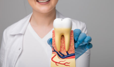 Usuwanie korzenia zęba - model zęba z korzeniem