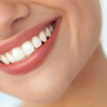 Licówki addytywne - bez szlifowania zębów
