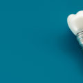 Ranking implantów zębów